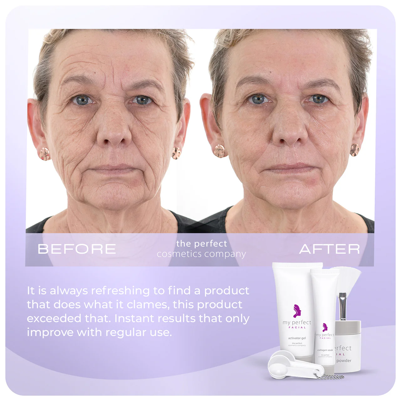 My Perfect Facial 5 Treatments - Image 4
