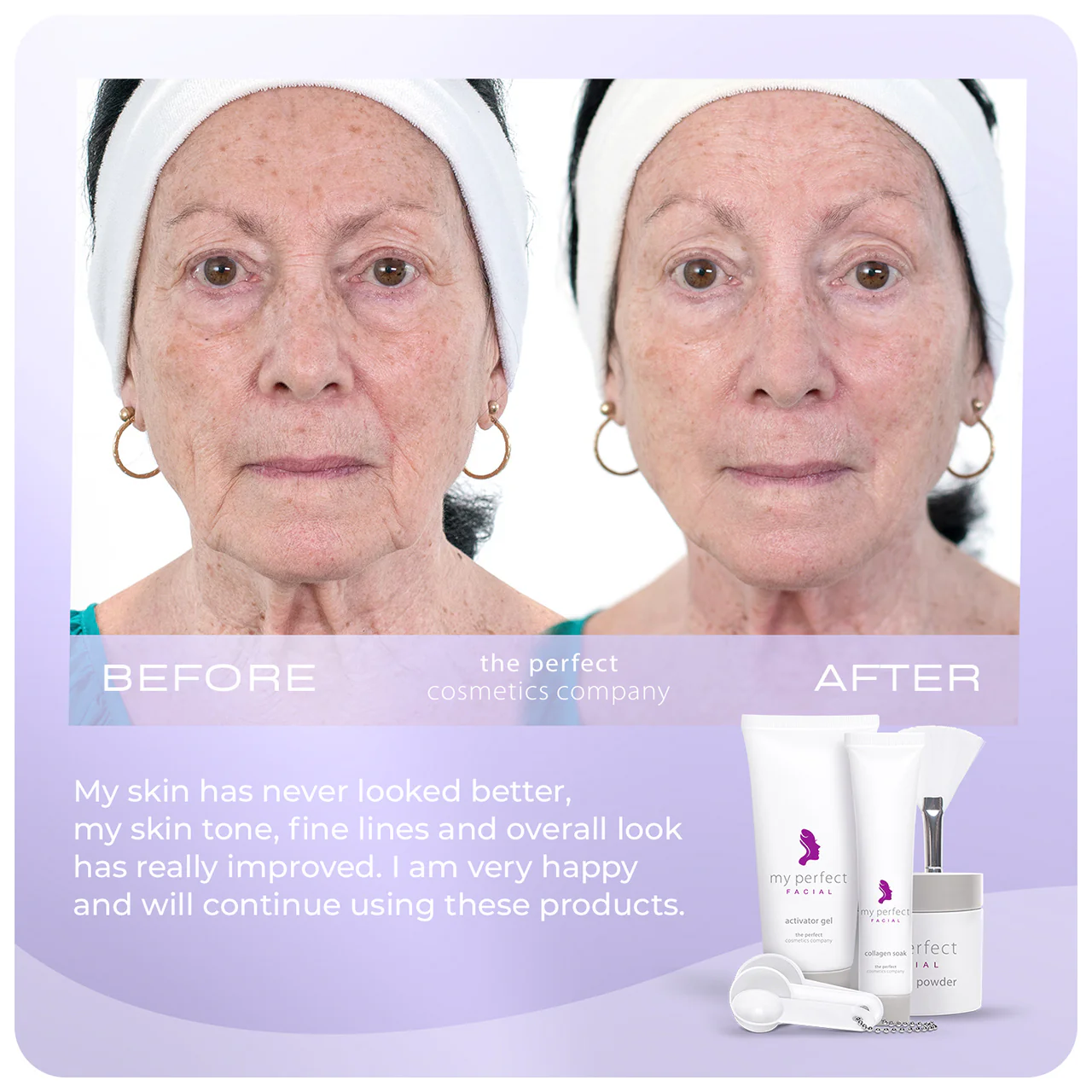 My Perfect Facial 5 Treatments - Image 5