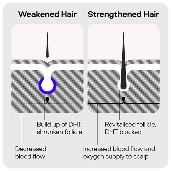 Sons Hair Loss Starter Bundle - Image 5